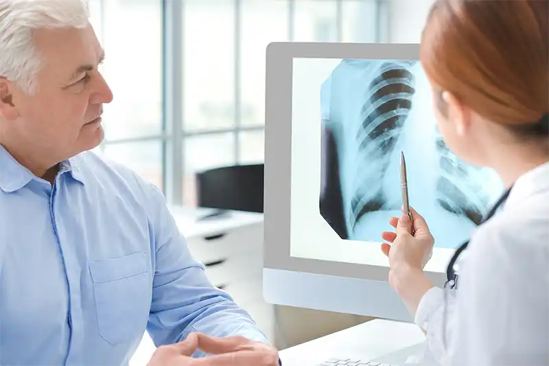 Vårdprogram, Svenska planeringsgruppen för lungcancer